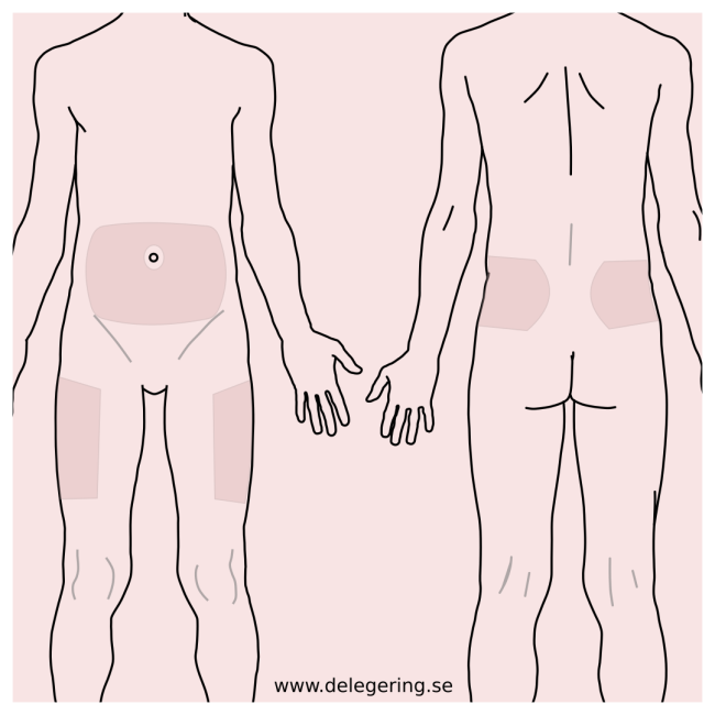 Schema injektion områden på kroppen